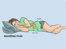 Trào ngược khi ngủ: Đừng tưởng nghỉ ngơi là dạ dày cũng nghỉ