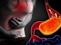 Khó thở, ợ nóng, … coi chừng trào ngược dạ dày đấy bà con!