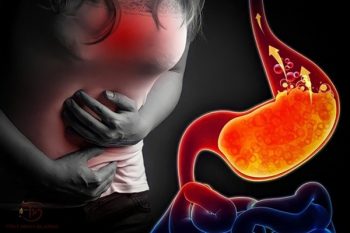 Khó thở, ợ nóng, … coi chừng trào ngược dạ dày đấy bà con!