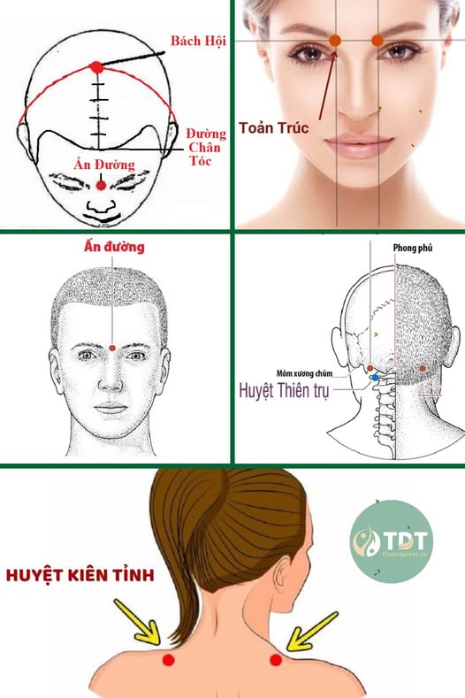 Bấm huyệt chữa đau đầu: 5 huyệt vị quý giúp khai thông khí huyết