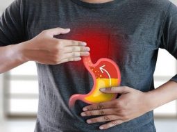 Làm thế nào để giảm axit dạ dày mà không hại cơ thể?