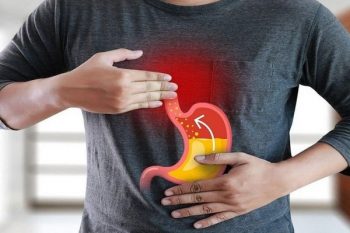 Làm thế nào để giảm axit dạ dày mà không hại cơ thể?