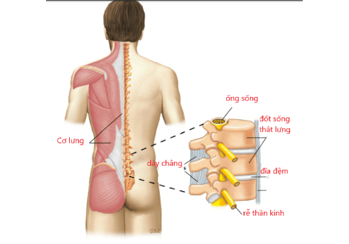 Đau lưng