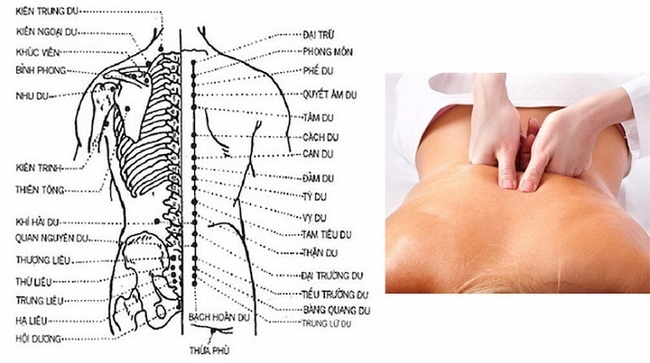 Bấm huyệt chữa thoát vị đĩa đệm: Phương pháp giảm đau không xâm lấn