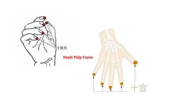 Huyệt Thập Tuyên có vị trí nằm ngay đầu ngón tay