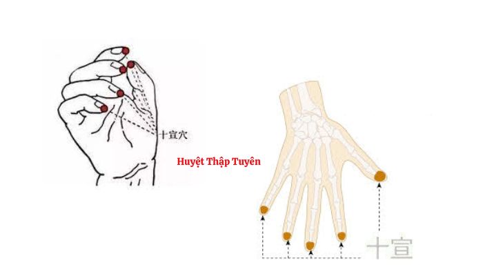 Huyệt Thập Tuyên có vị trí nằm ngay đầu ngón tay