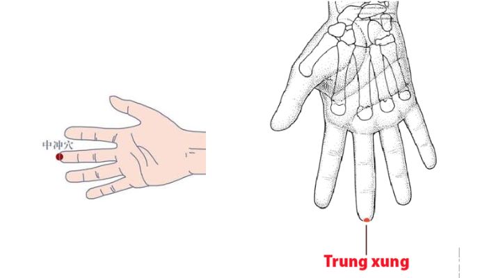 Huyệt Trung Xung nằm ở ngón tay giữa
