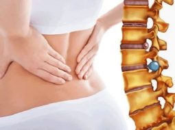 Phồng đĩa đệm: Nguyên nhân dấu hiệu và cách điều trị cổ truyền hiệu quả
