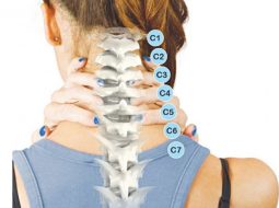 Thoái hóa đốt sống cổ: Nguyên nhân, triệu chứng và điều trị yhct