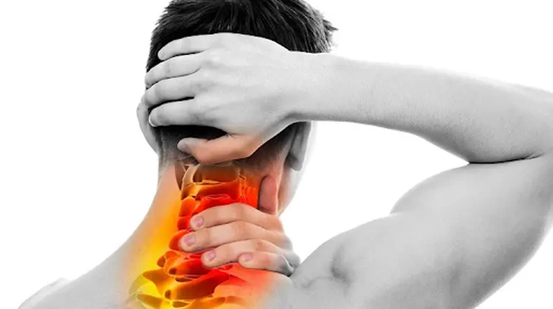 Biến chứng thoái hóa đốt sống cổ gây đau đầu