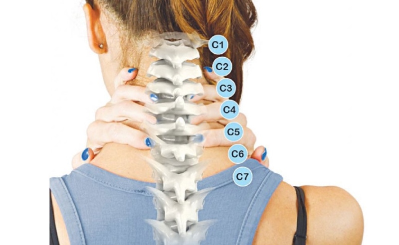 Thoái hóa đốt sống cổ: Nguyên nhân, triệu chứng và điều trị yhct