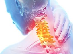 Thoát vị đĩa đệm cổ: Triệu chứng, nguyên nhân và phương pháp hỗ trợ phục hồi