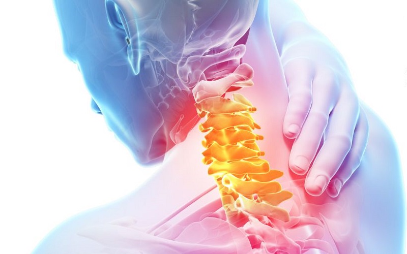 Thoát vị đĩa đệm cổ: Triệu chứng, nguyên nhân và phương pháp hỗ trợ phục hồi