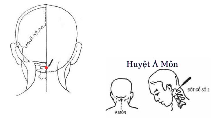 Huyệt Á Môn có vị trí nằm ngay sau đầu