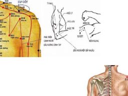 Huyệt Cự Cốt nằm ở ngay phần hõm vai