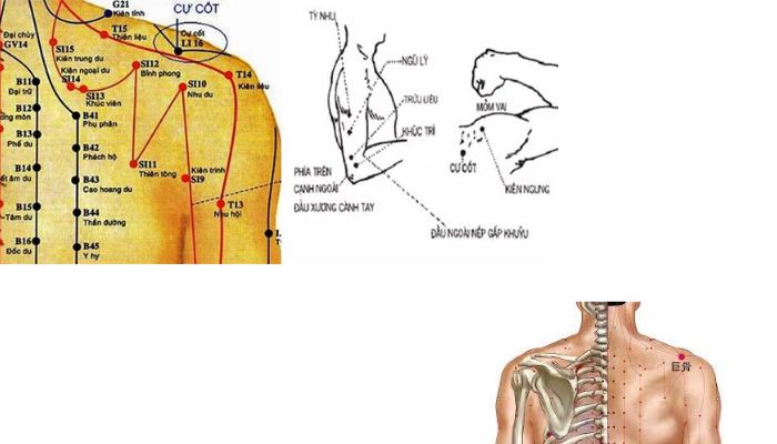 Huyệt Cự Cốt nằm ở ngay phần hõm vai