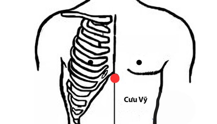 Huyệt Cưu Vĩ nằm ngay vùng xương ức