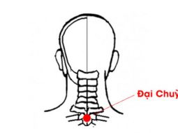 Huyệt Đại Chùy giúp giảm các cơn đau đầu, đau cổ vai gáy