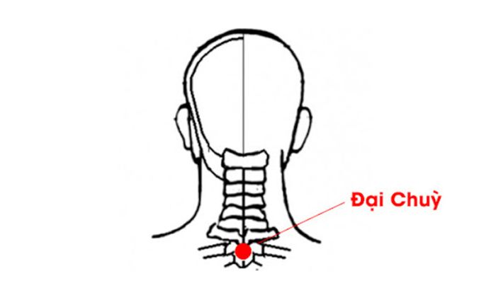 Huyệt Đại Chùy giúp giảm các cơn đau đầu, đau cổ vai gáy