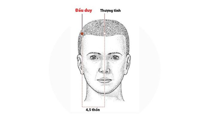 Huyệt Đầu Duy có vị trí nằm ở góc trán