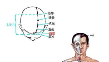 Huyệt Khúc Sai hỗ trợ giảm đau đầu nghẹt mũi rất hiệu quả