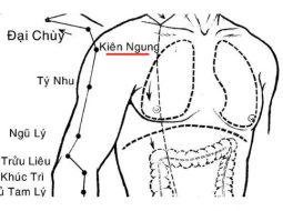 Huyệt Kiên Ngung có vị trí nằm ở phần vai