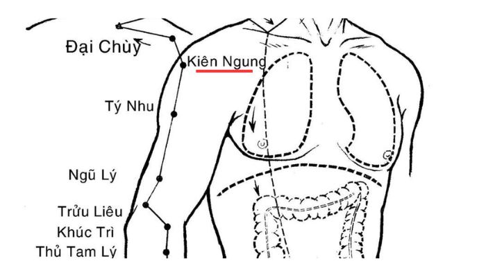 Huyệt Kiên Ngung có vị trí nằm ở phần vai