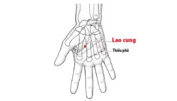 Huyệt Lao Cung có vị trí nằm trong lòng bàn tay