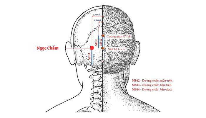 Huyệt Ngọc Chẩm có thể giúp giảm đau cổ vai gáy khá tốt