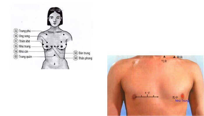 Huyệt Nhũ Trung có vị trí nằm ở ngực