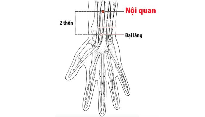 Huyệt Nội Quan giúp giảm tốt các triệu chứng khó chịu ở hệ tiêu hóa, thần kinh