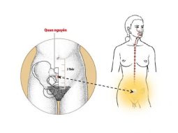 Huyệt Quan Nguyên có vị trí nằm dưới bụng dưới