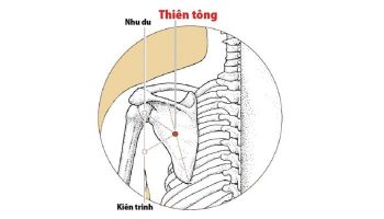 Huyệt Thiên Tông nằm ở vùng vai