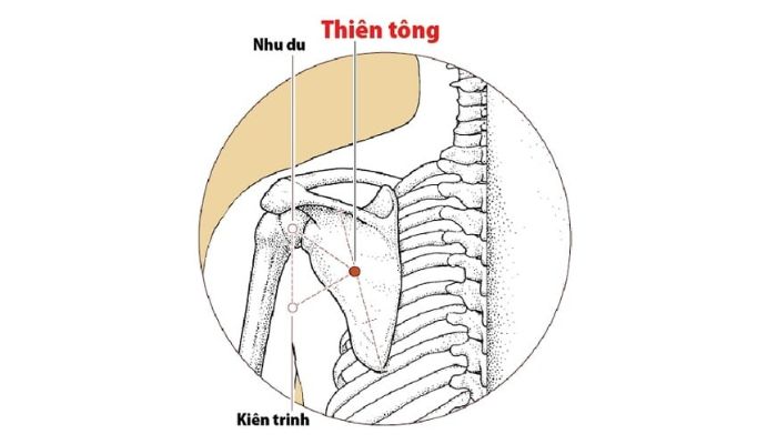 Huyệt Thiên Tông nằm ở vùng vai