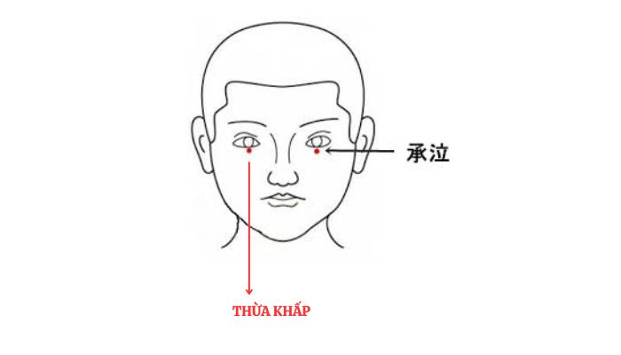 Huyệt Thừa Khấp nằm ngay dưới mắt