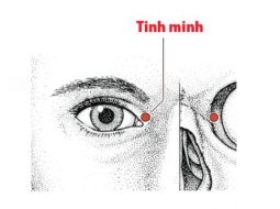 Huyệt Tinh Minh hỗ trợ chủ trị nhiều bệnh liên quan tới mắt
