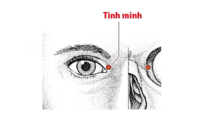 Huyệt Tinh Minh hỗ trợ chủ trị nhiều bệnh liên quan tới mắt