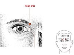 Huyệt Toản Trúc thường dùng trong trị bệnh vùng mắt, vùng trán và mũi