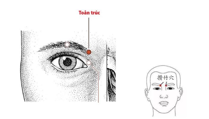 Huyệt Toản Trúc thường dùng trong trị bệnh vùng mắt, vùng trán và mũi