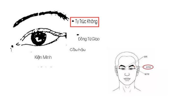 Huyệt Ty Trúc Không nằm ngay gần đuôi lông mày