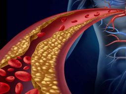 Rối loạn lipid máu là gì? Nguyên nhân, cách điều trị và phòng bệnh