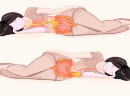 Trào ngược dạ dày nên nằm nghiêng bên nào cải thiện bệnh?