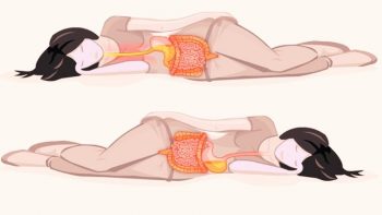 Trào ngược dạ dày nên nằm nghiêng bên nào cải thiện bệnh?
