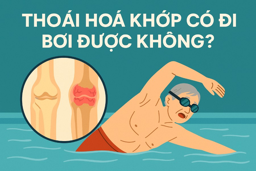 Thoái hóa khớp có đi bơi được không? Cách bơi tốt cho khớp