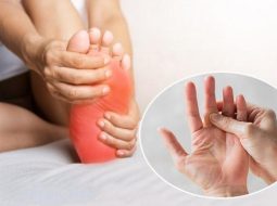 Nguyên nhân thoát vị đĩa đệm gây tê bì chân tay và giải pháp