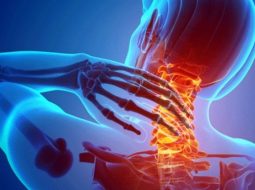 4 dấu hiệu nhận biết triệu chứng thoái hóa cột sống cổ sớm