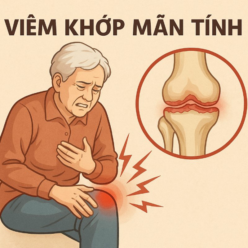 Triệu chứng viêm khớp mãn tính và giải pháp xử lý