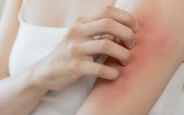 Ngứa tay chân nhưng không nổi mẩn: Nguyên nhân và cách điều trị từ góc nhìn y học cổ truyền