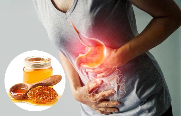 Cách làm giảm cơn đau dạ dày ngay lập tức tại nhà