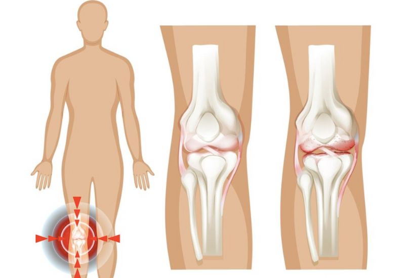 Khô khớp uống gì để dưỡng khớp, nhuận gân?